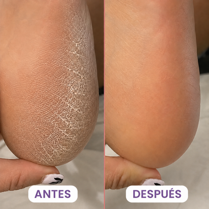 PedyGlow™ — Lima Eléctrica Antidurezas