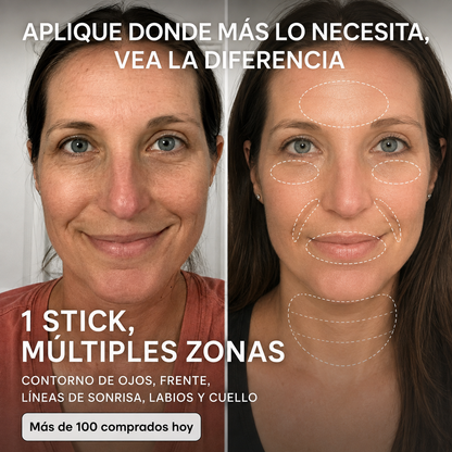 Eloria™ – Stick Repulpante PDRN con Colágeno Rosa