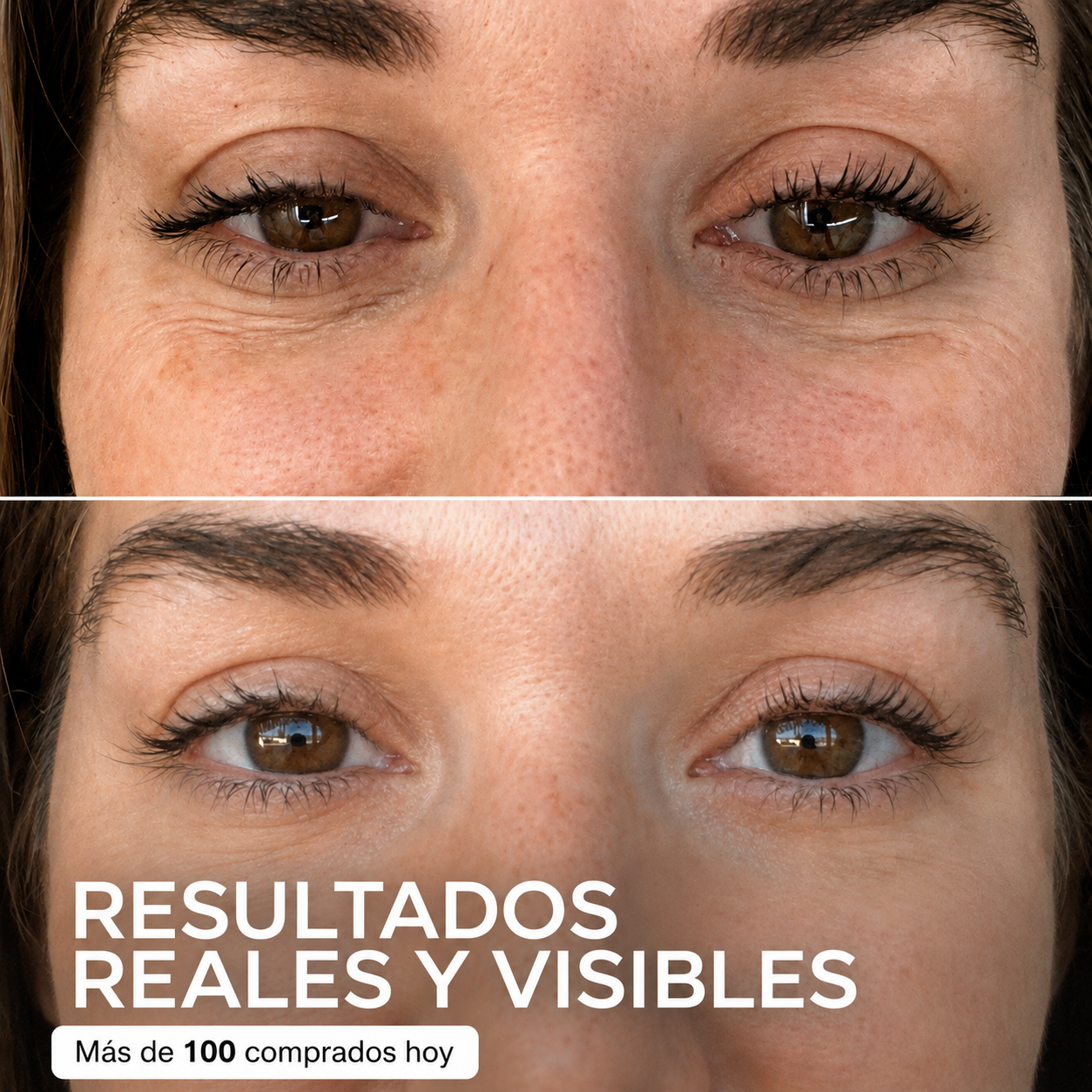 Eloria™ – Stick Repulpante PDRN con Colágeno Rosa