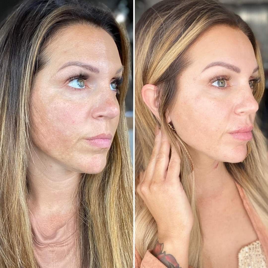 ¡Un cambio increíble en la piel!